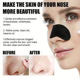 Deep Cleansing Pore Blackhead Remover Nose Strips (10)
